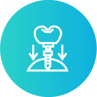 Root Canal Treatment